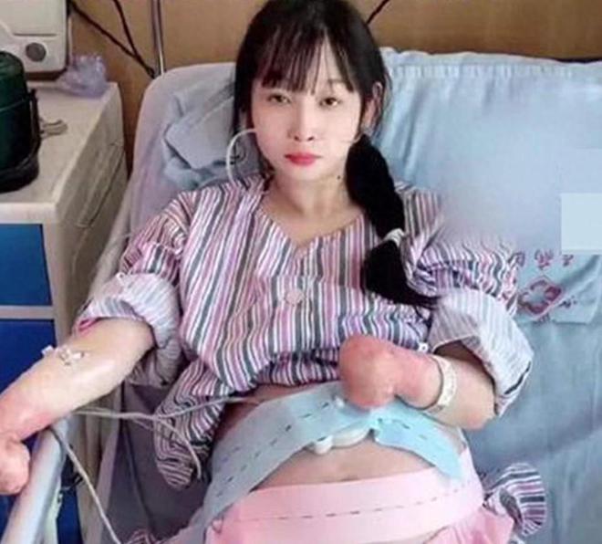 无手女孩怀孕遭辱骂“生怪胎”，其丈夫很伤心，网友怒斥辱骂者