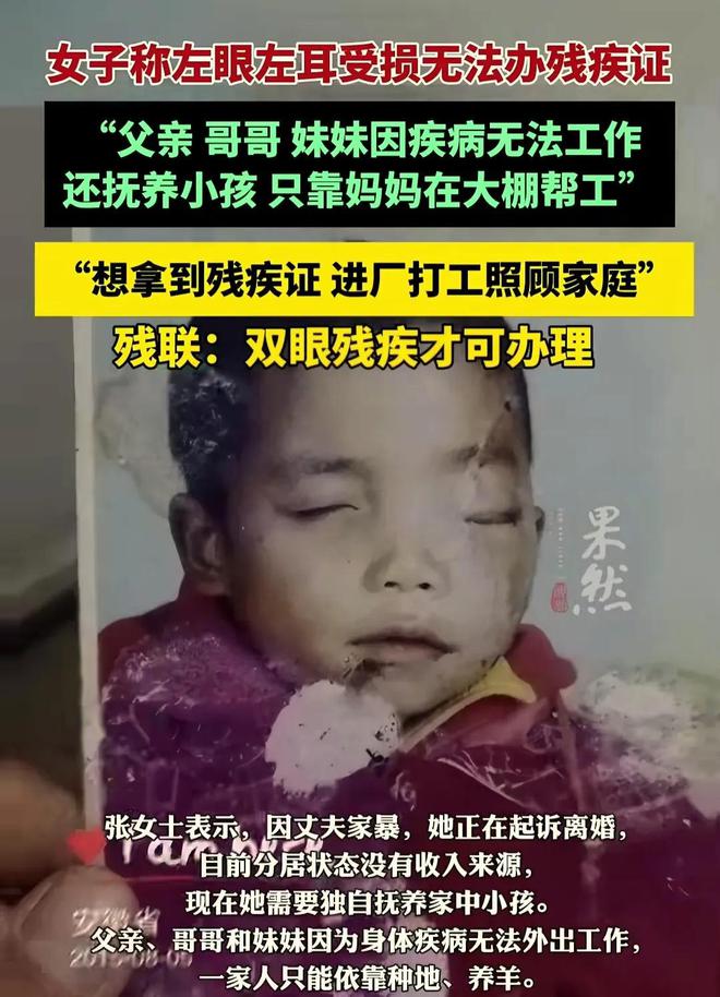 女子单眼失明拒发残疾证，残联：不够残疾标准！女子生活陷困境