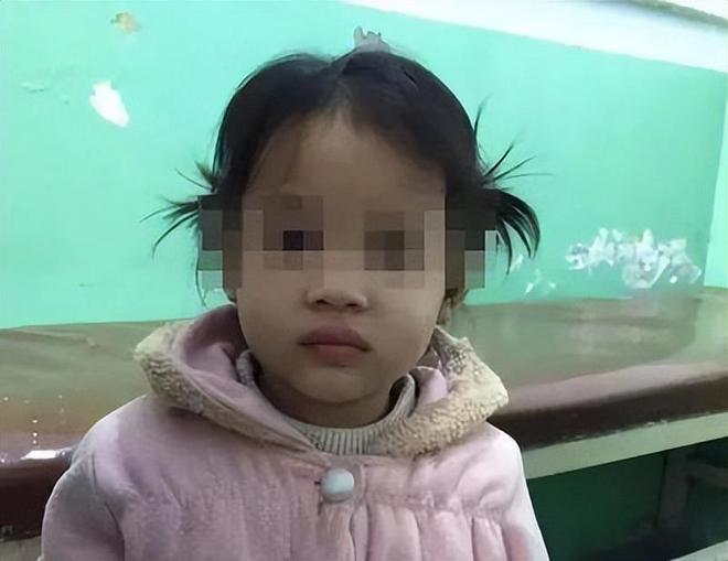 女子从小被拐卖，“养母”怕她被家人认走，竟然狠心割掉她的胎记