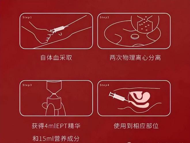 女性“高潮针”上热搜，究竟是不是“智商税”？医生有说法