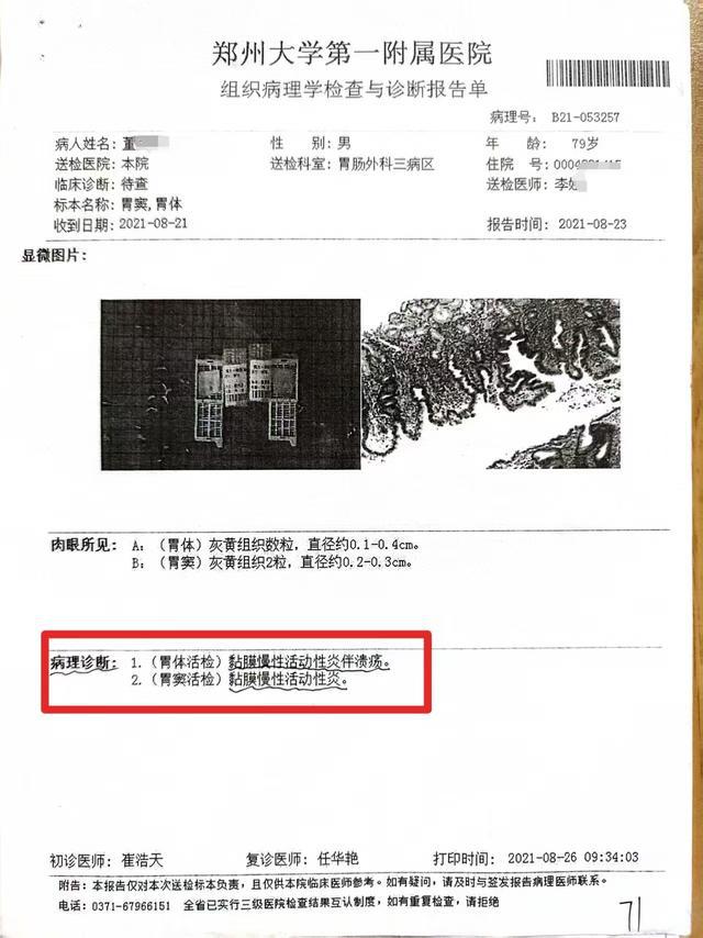79岁老先生患慢性胃炎，被按胃癌晚期切除全胃；两级鉴定：构成二级医疗事故，院方负主责