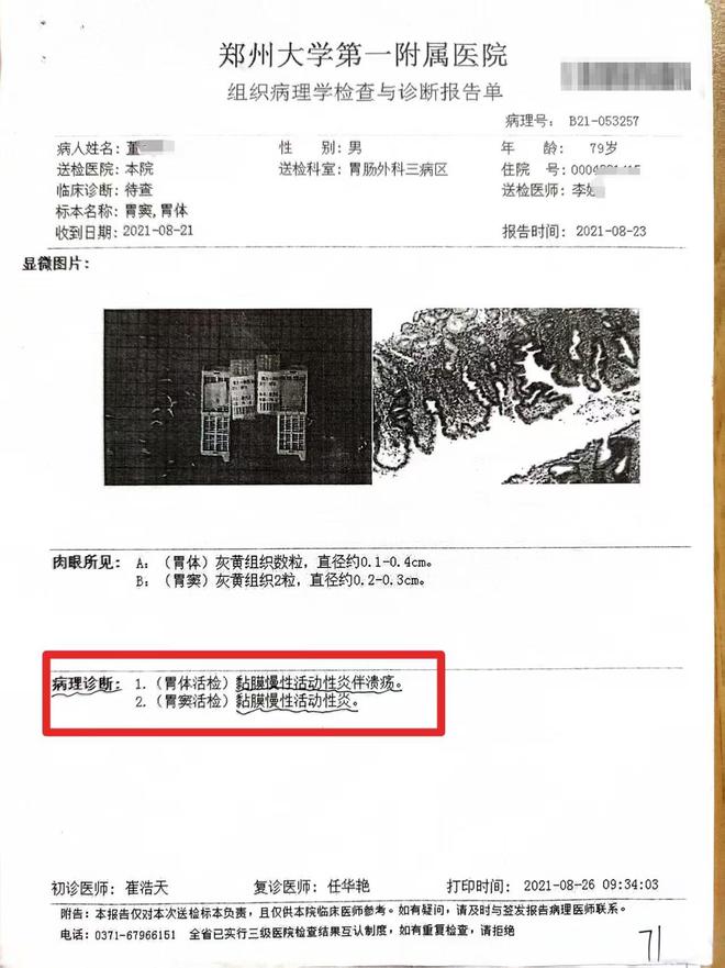 老汉患慢性胃炎，医生竟按胃癌晚期切除全胃，事发郑州，详情曝出