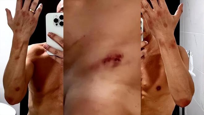 乱港男艺人曝猛料：曾遭男友人“迷奸”两次，细数被“迷奸”过程