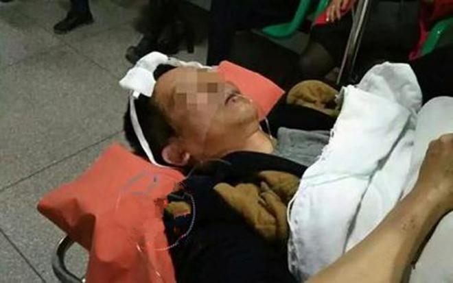 男子被打获赔300万，父子被控敲诈！接着，案子反复翻转，很奇葩
